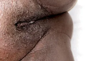 Darkskin With A Fat Ass🍫 , Wet Pussy😜💦 Qv Specials 🥳 24/7 - Image 5